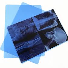 Ink-Jet X Ray Films 100 Sheets Per Packet 8*10.
