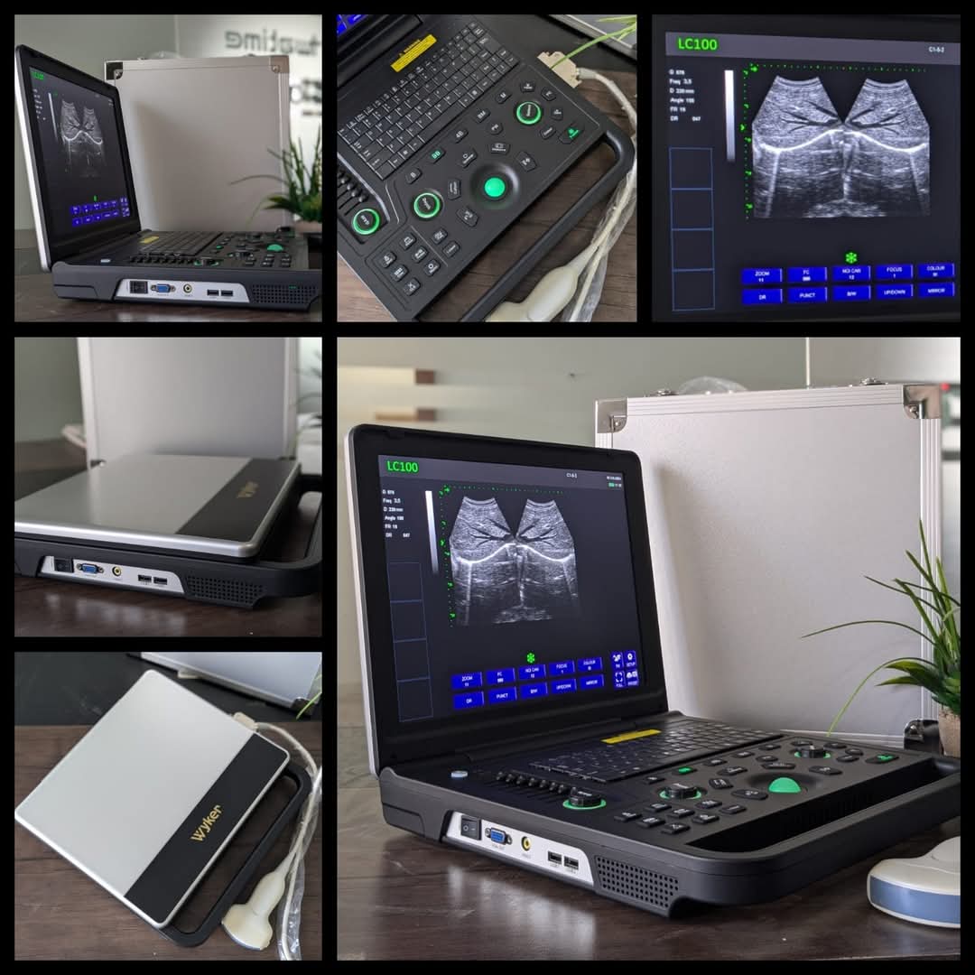 Wyker LC100 Portable Ultrasound Machine.